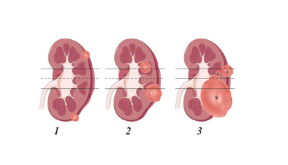 ʳҪעЩ