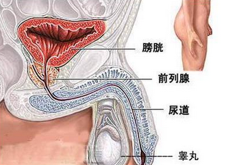 前列腺癌