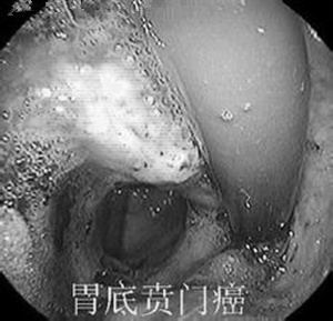 ���Ű��Ĳ���֢����Щ