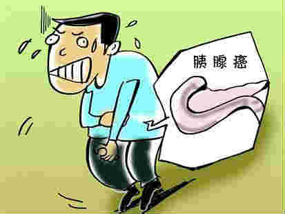 胰腺癌