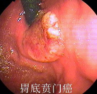 ���Ű��������ƺ������Щ����֢