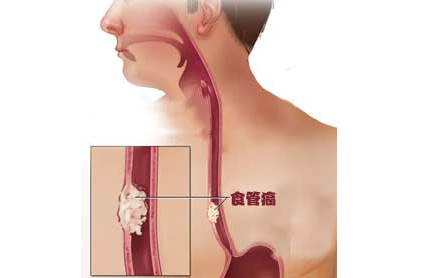 ʳ