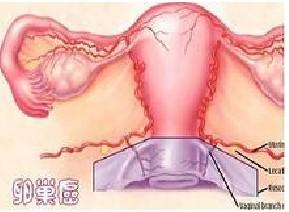 卵巢囊肿与卵巢癌症状有哪些区别
