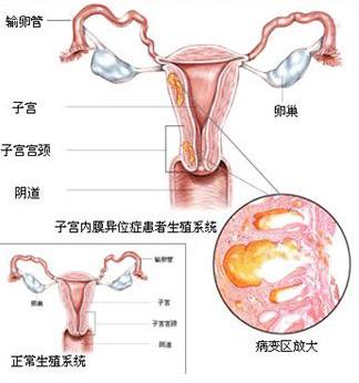 ӹĤձ鷽