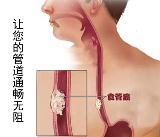 ʳҪô