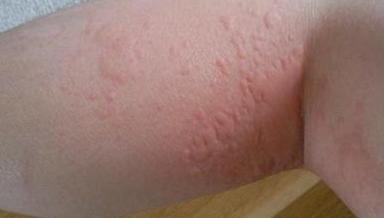 �ܰͰ����Е���֢״