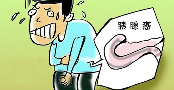 糖尿病会诱发胰腺癌