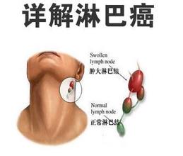 ܰͰΪʲôḴ