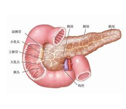 胰腺癌手术治疗并发症