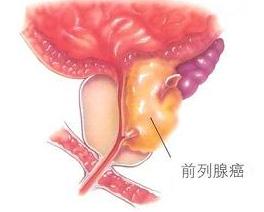 http://www.wd999.com/qianliexianai/qianliexianaifufa/49656.html