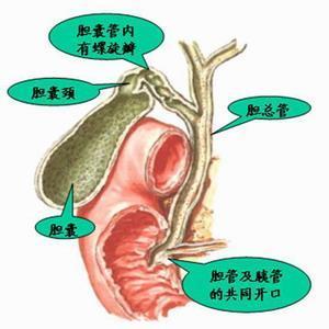 胆管癌的常见治疗方式
