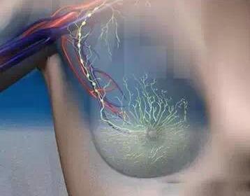 乳腺癌放疗有何危害