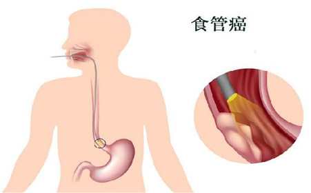 ʳƷ