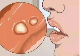ǻʶ