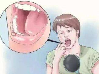 ǻƷʲô