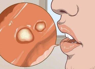 ǻЩ