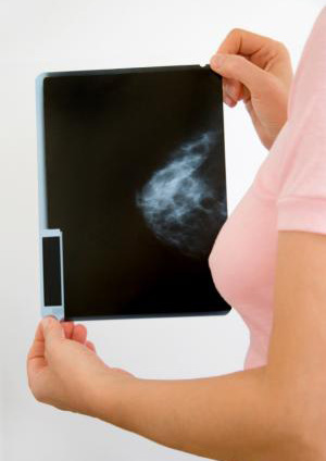 乳腺癌的诊断方式