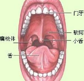 颌骨鳞癌