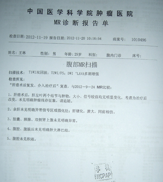 原发性肝癌患者术后2012年11月20日复查结果