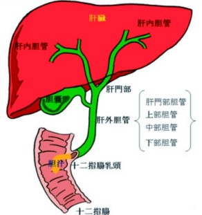 胆管癌的内镜治疗