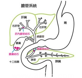 胆管癌的主要症状
