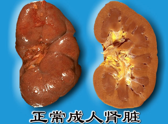 可导致人们患有肾癌的病因有哪些呢?