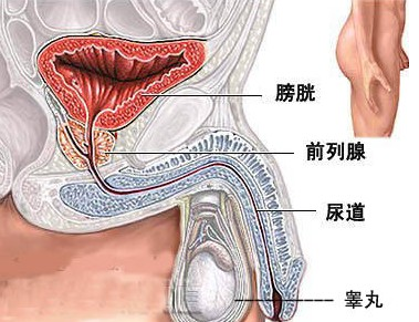 膀胱癌晚期会出现哪些并发症?