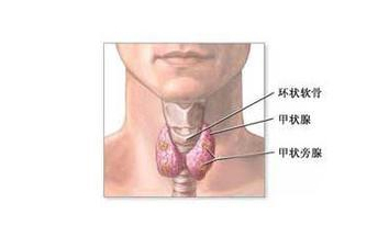淋巴结肿大,甲状腺癌