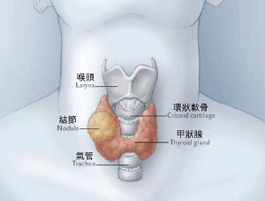 甲状腺癌,饮食护理