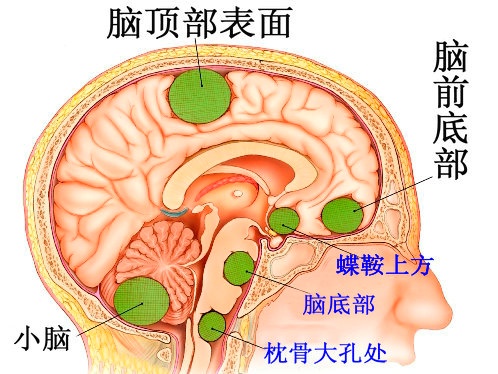 ,ڲ֢