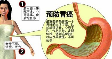 诱发胃癌